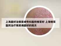 上海最好治银屑病专科医院哪家好 上海哪家医院治疗银屑病最好的地方