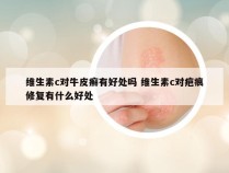 维生素c对牛皮癣有好处吗 维生素c对疤痕修复有什么好处