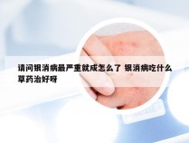 请问银消病最严重就成怎么了 银消病吃什么草药治好呀