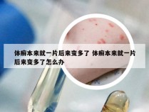 体癣本来就一片后来变多了 体癣本来就一片后来变多了怎么办