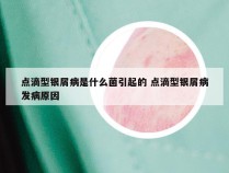 点滴型银屑病是什么菌引起的 点滴型银屑病发病原因