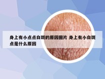 身上有小点点白斑的原因图片 身上有小白斑点是什么原因