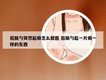 后脑勺突然起癣怎么就医 后脑勺起一片癣一样的东西