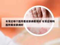 石家庄哪个医院看皮肤病看得好 石家庄哪所医院看皮肤病好