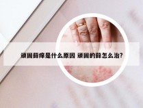 顽固藓痒是什么原因 顽固的藓怎么治?