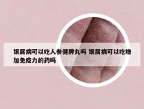 银屑病可以吃人参健脾丸吗 银屑病可以吃增加免疫力的药吗