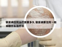 银屑病住院治疗需要多久 银屑病要住院一般采取什么治疗法