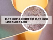 腿上有绿豆的小白点是啥意思 腿上有绿豆大小的圆白点是怎么回事