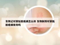 生物记对掌趾脓疱病怎么样 生物制剂对掌跖脓疱病有效吗