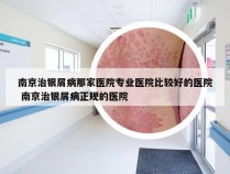 南京治银屑病那家医院专业医院比较好的医院 南京治银屑病正规的医院