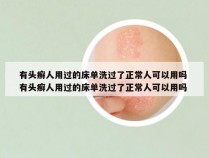 有头癣人用过的床单洗过了正常人可以用吗 有头癣人用过的床单洗过了正常人可以用吗