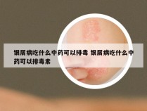 银屑病吃什么中药可以排毒 银屑病吃什么中药可以排毒素