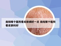 南阳哪个医院看皮肤病好一点 南阳那个医院看皮肤科好