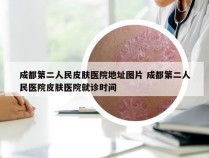 成都第二人民皮肤医院地址图片 成都第二人民医院皮肤医院就诊时间