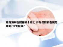 开封潮癣医院在哪个路上 开封皮肤科医院是哪家?位置在哪?