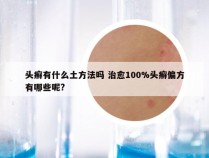 头癣有什么土方法吗 治愈100%头癣偏方有哪些呢?