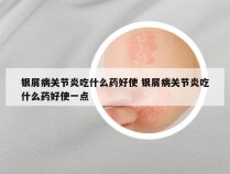 银屑病关节炎吃什么药好使 银屑病关节炎吃什么药好使一点