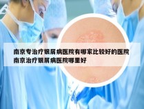 南京专治疗银屑病医院有哪家比较好的医院 南京治疗银屑病医院哪里好