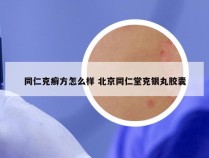 同仁克癣方怎么样 北京同仁堂克银丸胶囊