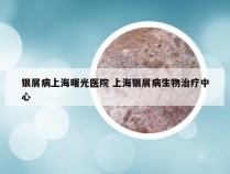 银屑病上海曙光医院 上海银屑病生物治疗中心