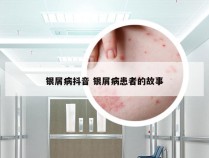 银屑病抖音 银屑病患者的故事