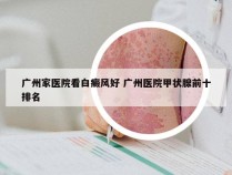 广州家医院看白癜风好 广州医院甲状腺前十排名