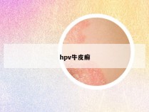 hpv牛皮癣