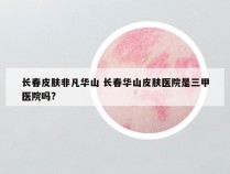 长春皮肤非凡华山 长春华山皮肤医院是三甲医院吗?