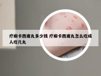 疗癣卡西甫丸多少钱 疗癣卡西甫丸怎么吃成人吃几丸