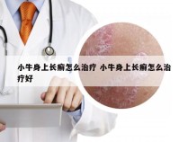 小牛身上长癣怎么治疗 小牛身上长癣怎么治疗好