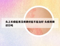 头上长癣能用没用碘伏能不能治好 头癣用碘伏行吗