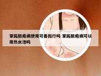 掌跖脓疱病使用可善挺行吗 掌跖脓疱病可以用热水泡吗