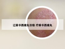 辽藓卡西甫丸价格 疗癣卡西甫丸