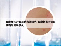 细胞免疫对银屑病有效果吗 细胞免疫对银屑病有效果吗多久