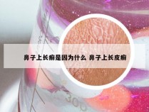 鼻子上长癣是因为什么 鼻子上长皮癣