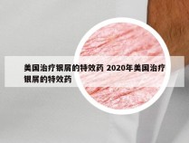 美国治疗银屑的特效药 2020年美国治疗银屑的特效药