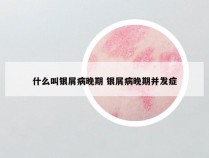 什么叫银屑病晚期 银屑病晚期并发症