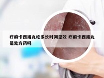 疗癣卡西甫丸吃多长时间见效 疗癣卡西甫丸是处方药吗