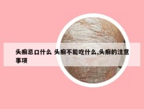 头癣忌口什么 头癣不能吃什么,头癣的注意事项