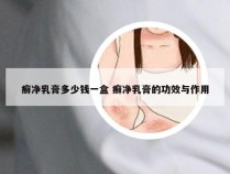 癣净乳膏多少钱一盒 癣净乳膏的功效与作用