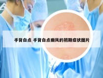 手背白点 手背白点癫风的初期症状图片