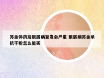 苏金停药后银屑病复发会严重 银屑病苏金单抗干粉怎么能买