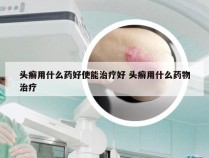 头癣用什么药好使能治疗好 头癣用什么药物治疗