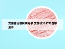 艾儒棣治银屑病方子 艾儒棣2017年在哪坐诊