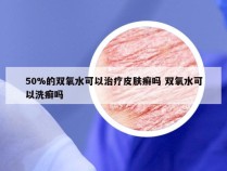 50%的双氧水可以治疗皮肤癣吗 双氧水可以洗癣吗