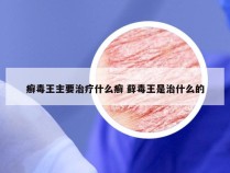 癣毒王主要治疗什么癣 藓毒王是治什么的