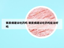 银屑病建议吃药吗 银屑病建议吃药吗能治好吗