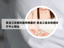 黑龙江白癜风医院哪最好 黑龙江省白斑病诊疗中心地址