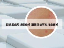 副银屑病可以运动吗 副银屑病可以打疫苗吗