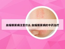 血燥银屑病注意什么 血燥银屑病的中药治疗